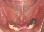 術前口腔内写真